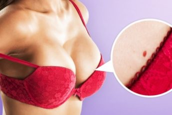 Что означают эти красные точки на коже?