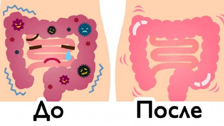 ochishhenie-1