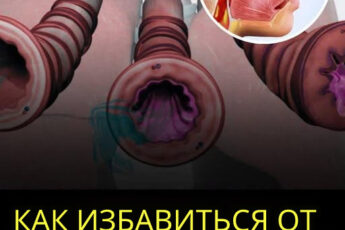 Хорошо, что есть несколько способов, которые вы можете предпринять дома, чтобы облегчить отхождение слизи и улучшить дыхание...