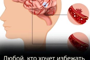 Желающим предотвратить инсульт необходимо незамедлительно включить в питание эти 15 продуктов