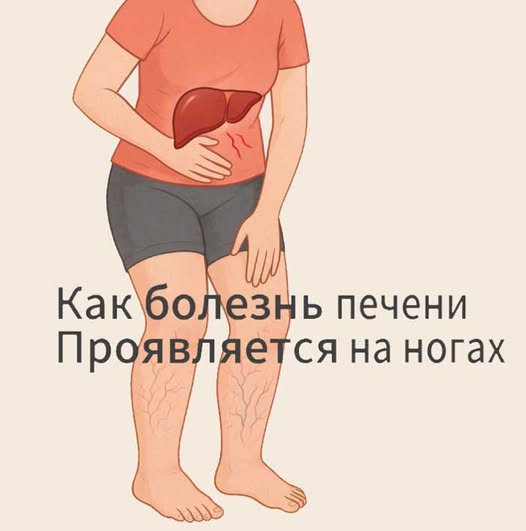 Ваши ноги кричат о проблемах с печенью! 7 тревожных сигналов, которые нельзя игнорировать