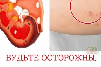9 симптомов заболевания почек и почечной недостаточности, которые должен знать каждый