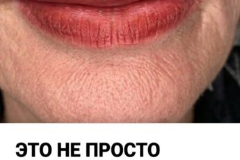 Поджелудочная железа работает на износ: 7 тревожных признаков на лице, которые люди в возрасте часто оставляют без внимания
