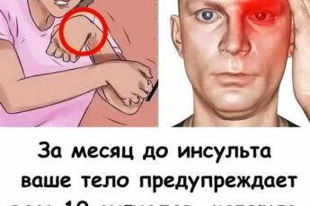 Врачи предупреждают: инсульт начинается за 30 дней, но мало кто это понимает.